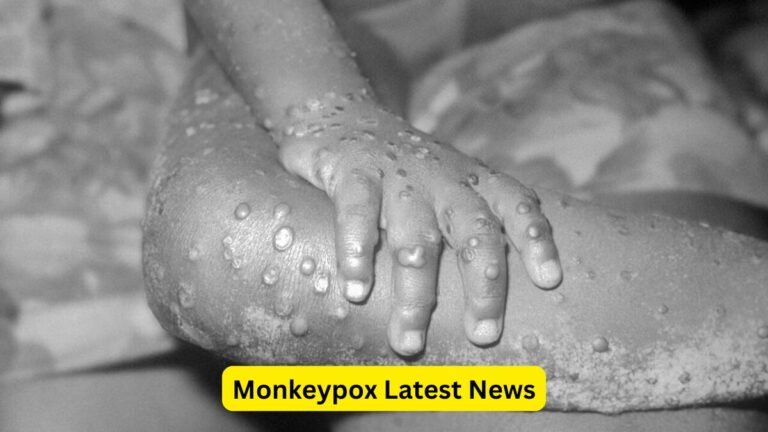 Monkeypox Latest News