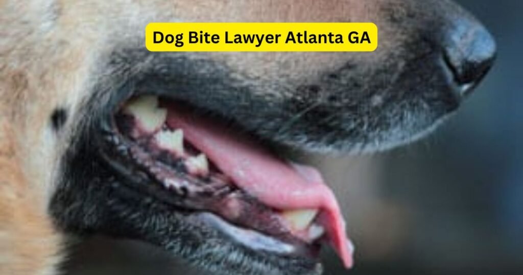 Dog Bite Lawyer Atlanta GA