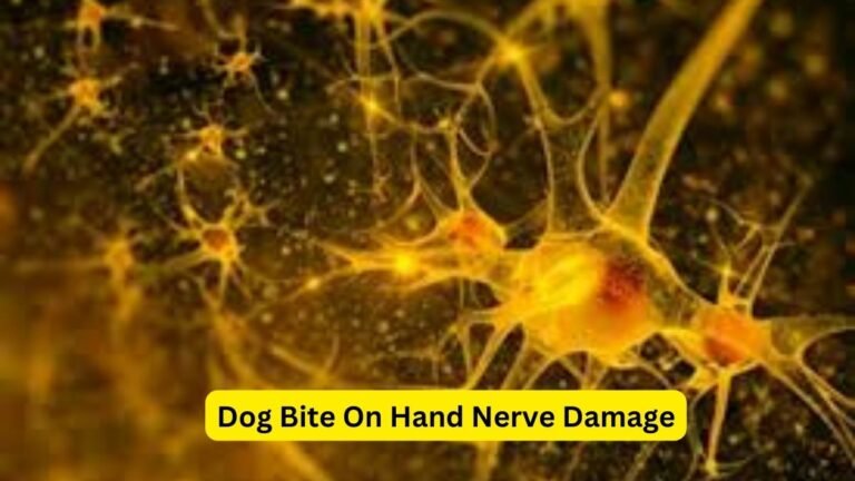 Dog Bite On Hand Nerve Damage